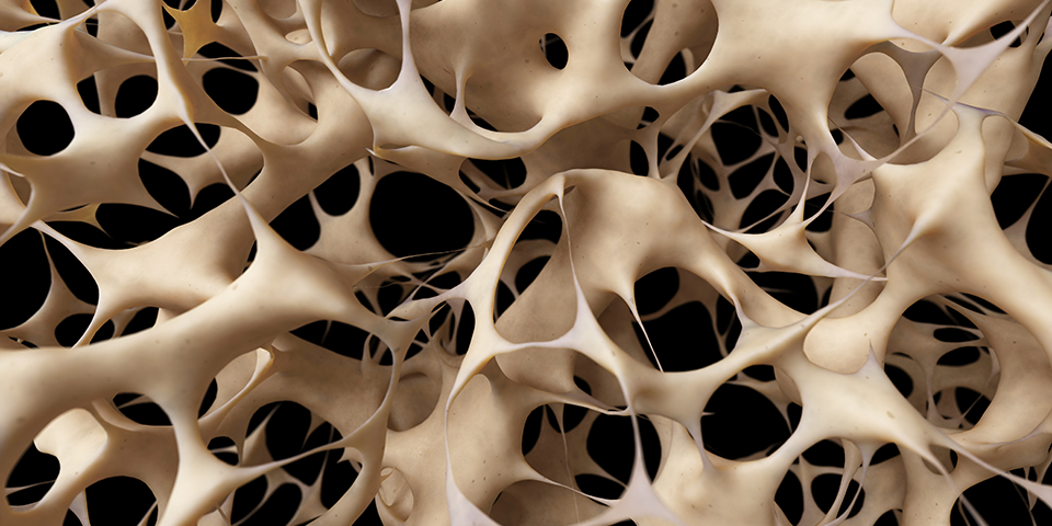 Osteoporosis can be erased with physical therapy - Hampton PT